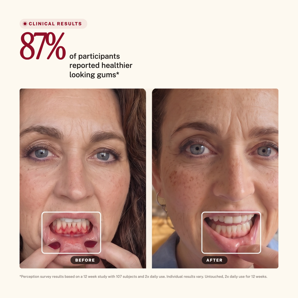 Sirius Red + Blue Light Toothbrush — 87% of participants reported healthier looking gums
